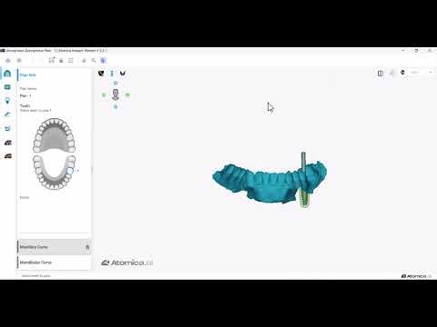 Changing teeth numbering system