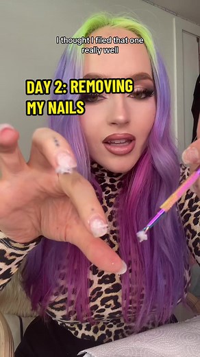 Removing Gel Nails at Home: Day 2 Nail Removal Process