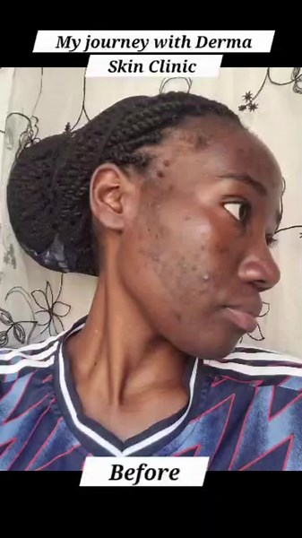 Derma Skin Clinic in Ntinda, Kampala: Skin Care & Treatment