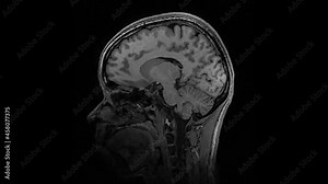 Human brain MRI on Black Background 4k footage