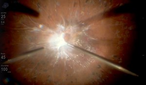 The Diabetic TRD Playbook - Eyetube