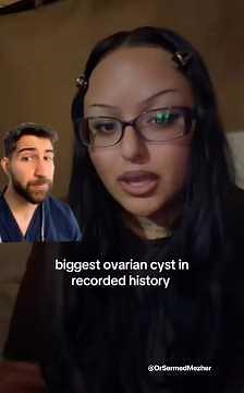 Guess the Largest Ovarian Cyst? Doctor Explains