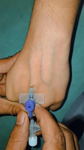 iv cannulation technique 🩺🏥 #ytshorts #song #love #ivcannulation #doctor