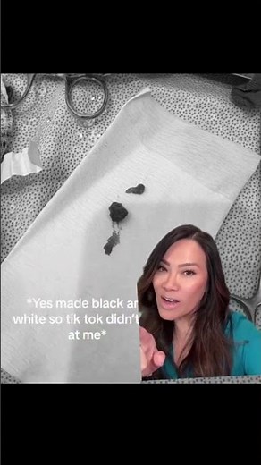 What a jawline and what a good place to have a cyst @coltonarman