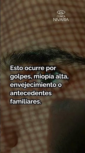 ¿Qué es el Desprendimiento de Retina y cuáles son sus causas?