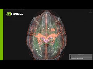 Uniting Doctors with Data Scientists to Accelerate AI in Medicine