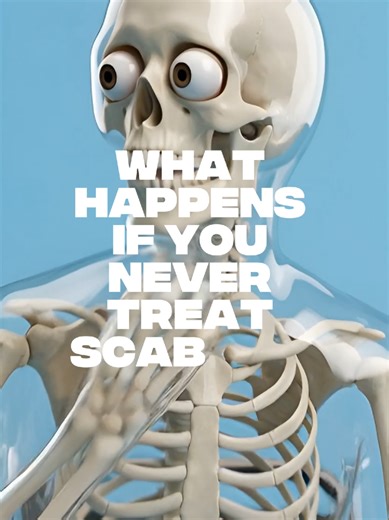 What You Need to Know About Scabies: Symptoms and Treatment