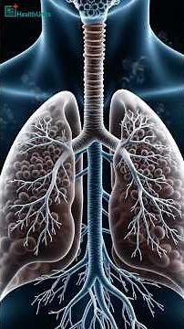 What Pneumonia Does to Your Lungs 🫁 | Health Units