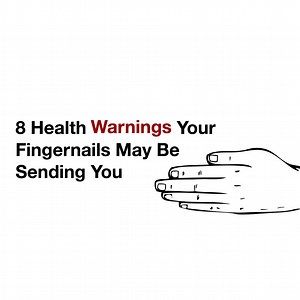 8 Health Warnings Your Fingernails May Be Sending You
