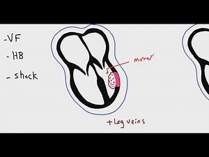 Systemic pathology 6 : CVS ( myocardial infarction ) DR.SAMEH GHAZY