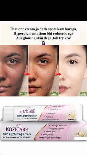 Darkspot Cream |Kozicare Skin Whiteningg Cream Review| फायदे और नुकसान|केसे लगाऐ |गोरा होने की क्रीम