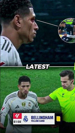 Bellingham got a yellow card for bleeding but the guy who elbowed him got no card in La Liga.🤣💀