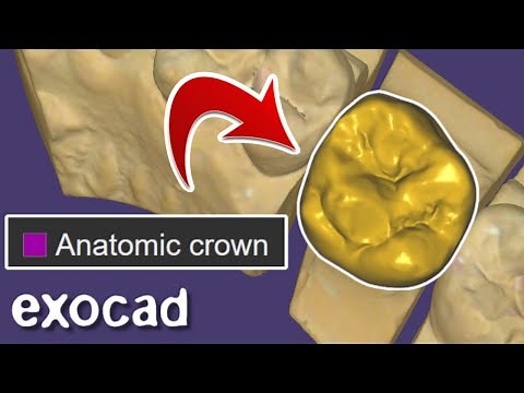 CROWN Design EXOCAD. 2024 Tutorial