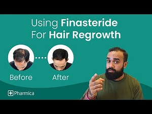 How To Use Finasteride Safely & Effectively | Hair Loss Treatment For Men
