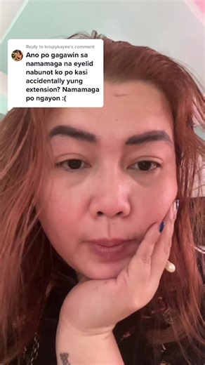 Eyelid Swelling: Causes, Symptoms, and Remedies