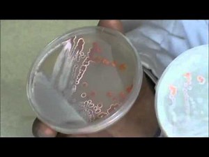 Técnicas básicas de Microbiología: Morfología de la bacteria Streptomyces griseoaurantiacus