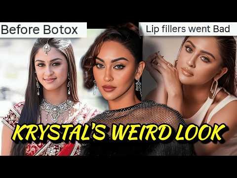 KRYSTAL DSOUZA BAD NOSE JOB & LIP FILLERS: GLORIFYING WEIRD BEAUTY STANDARDS & FAKE CONFIDENCE