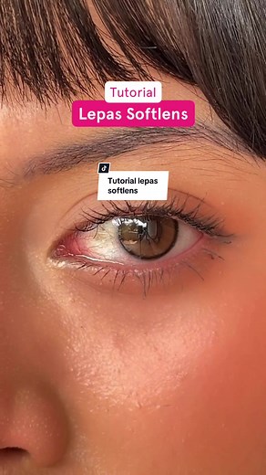 Tutorial Melepas Softlens dengan Mudah dan Aman