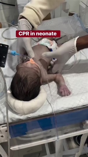عمل CPR في حديثي الولادة: دليل شامل
