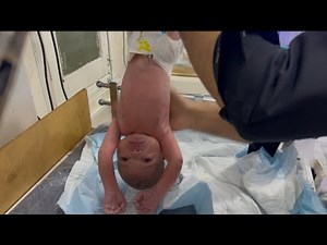 Newborn Baby Delay Cry After Resuscitation | IV Line Insertion Step by Step in NICU Care 💉 #nicucare