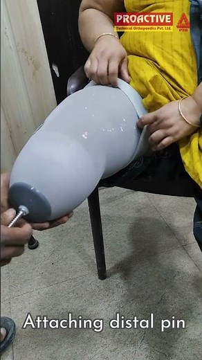 Amputation to Ambulation: Journey with a Below-Knee Prosthesis #belowkneeamputee #prosthesis