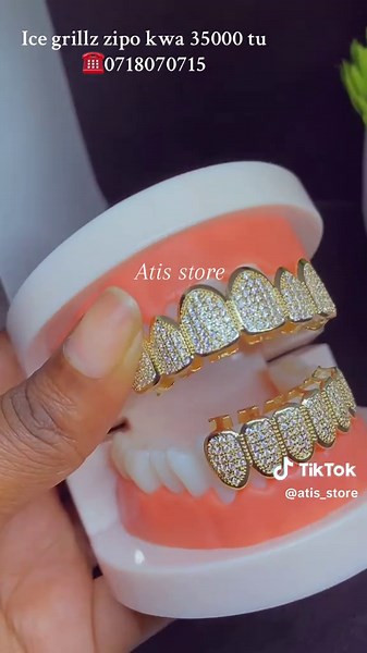 Ice Grillz: Fashion Braces at Affordable Prices