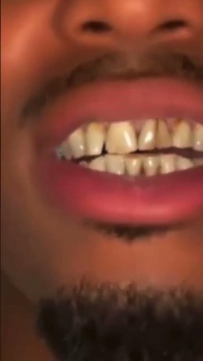 Quavo shows his teeth without the grillz.