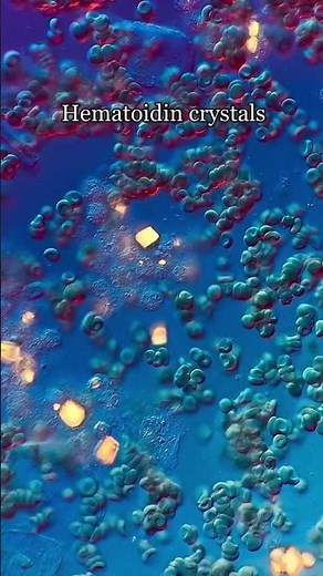 FYI period blood looks like this under a microscope! #menstruation #periods #science