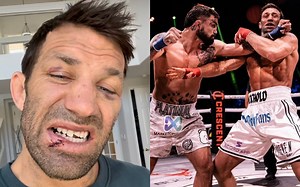 WATCH: Luke Rockhold shows off broken tooth and stitched-up lower lip following TKO loss against Mike Perry at BKFC 41