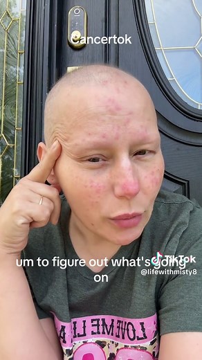 Managing Chemo Rash: Treatment Options and Duration