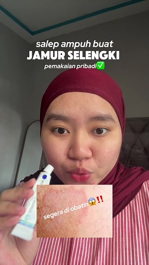 Mengatasi Gatal di Selengki dengan Miconazole