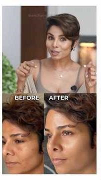 This Isn’t Even an LED Mask: Using a 4D Laser at Home Changed My Skin