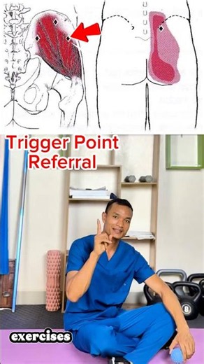 Glutes Trigger point Release