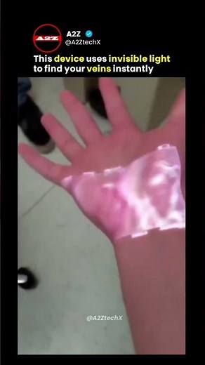 This Smart Infrared Light Makes Human Veins Instantly Visible