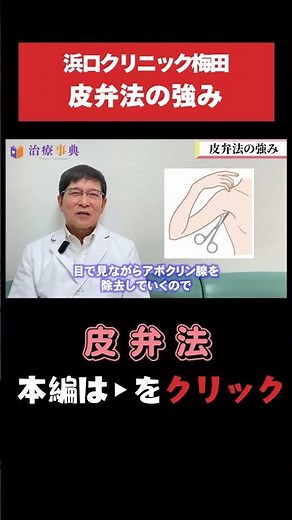 【皮弁法】皮弁法の強み！再発リスクを抑えます｜ワキガ治療の手術法 #ワキガ #体臭 #皮弁法