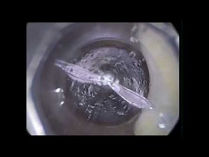 OPTIVIEW ENTRY IN ADHESIONS