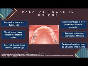 SL009 : Palatal Rugae Anatomy Based On Classification Of Thomas And Kotze as A Media in Self-Human
