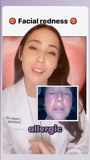 Causes of Facial Redness