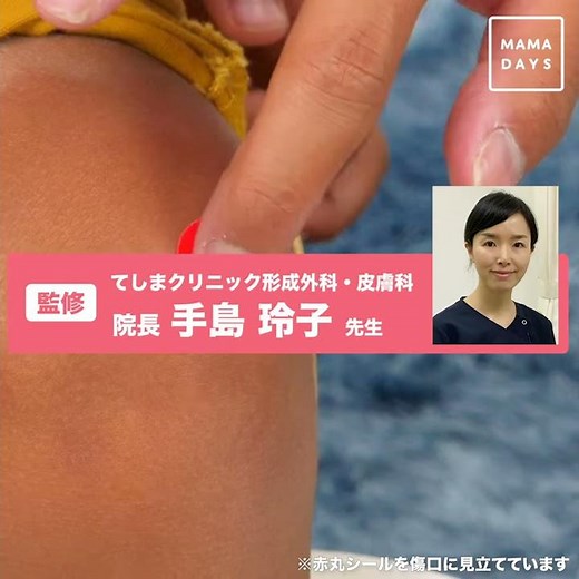 傷は洗い流して乾かさない！ 湿潤療法とは（形成外科医監修）