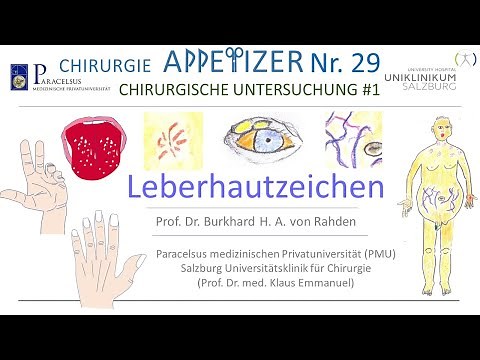 Liver skin sign SURGERY APPetizer No. 29 - Surgical Examination No. 1