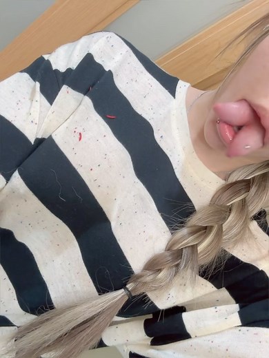 Popcorn | 适应新舌头👅的第一天 | Instagram