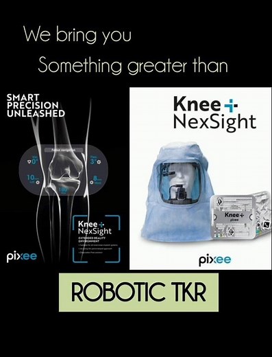 Most advance knee replacement surgery with Robotic pixee AR(augmented reality)-1st in vadodara