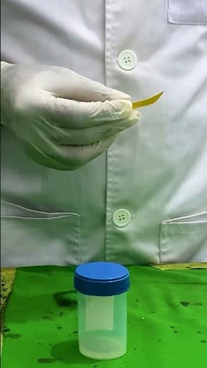 Semen Analysis Test Lab | Check pH | male reproductive system#seminal #semen #science #chemistry