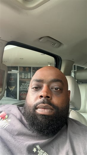 Outrageous_2.0 | Yep imma bald nigga | Instagram