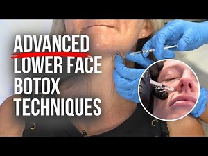 ADVANCED Lower Face Botox Techniques