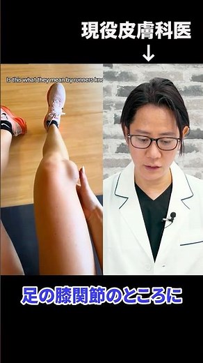 A practicing dermatologist explains bursitis #shorts