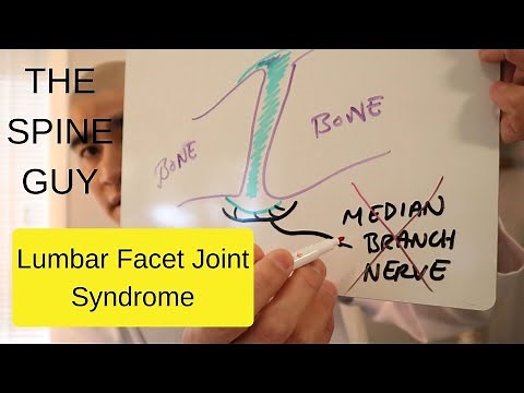 Lumbar Facet Joint Syndrome