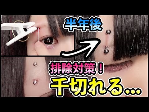 [Emergency] Things to remember before your earring is removed (torn off)!