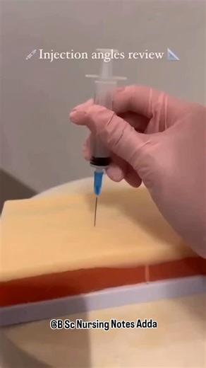 𝐁.𝐒𝐜.𝐍𝐮𝐫𝐬𝐢𝐧𝐠 𝐍𝐨𝐭𝐞𝐬 𝐀𝐝𝐝𝐚 | Injection Angles — Quick Review 💉 Intradermal (ID): 👉 5°–15° (very shallow) Subcutaneous (SC): 👉 45° or 90° (depends on fat layer)... | Instagram