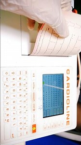 ECG Printing Out! Follow for ECG Interpretation Videos#medicalprocedure